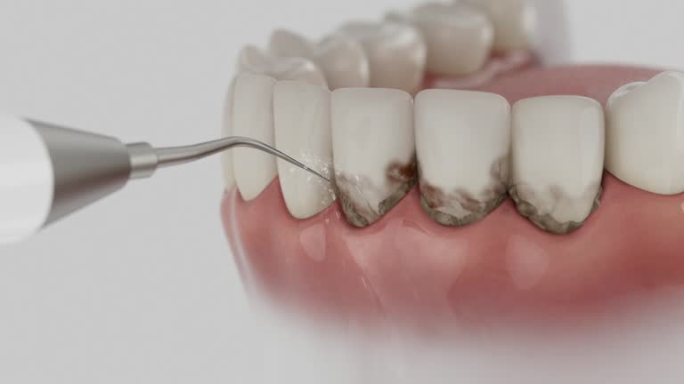 Trusted Teeth Cleaning And Checkup service in West Union, OH - Dentist Open Now